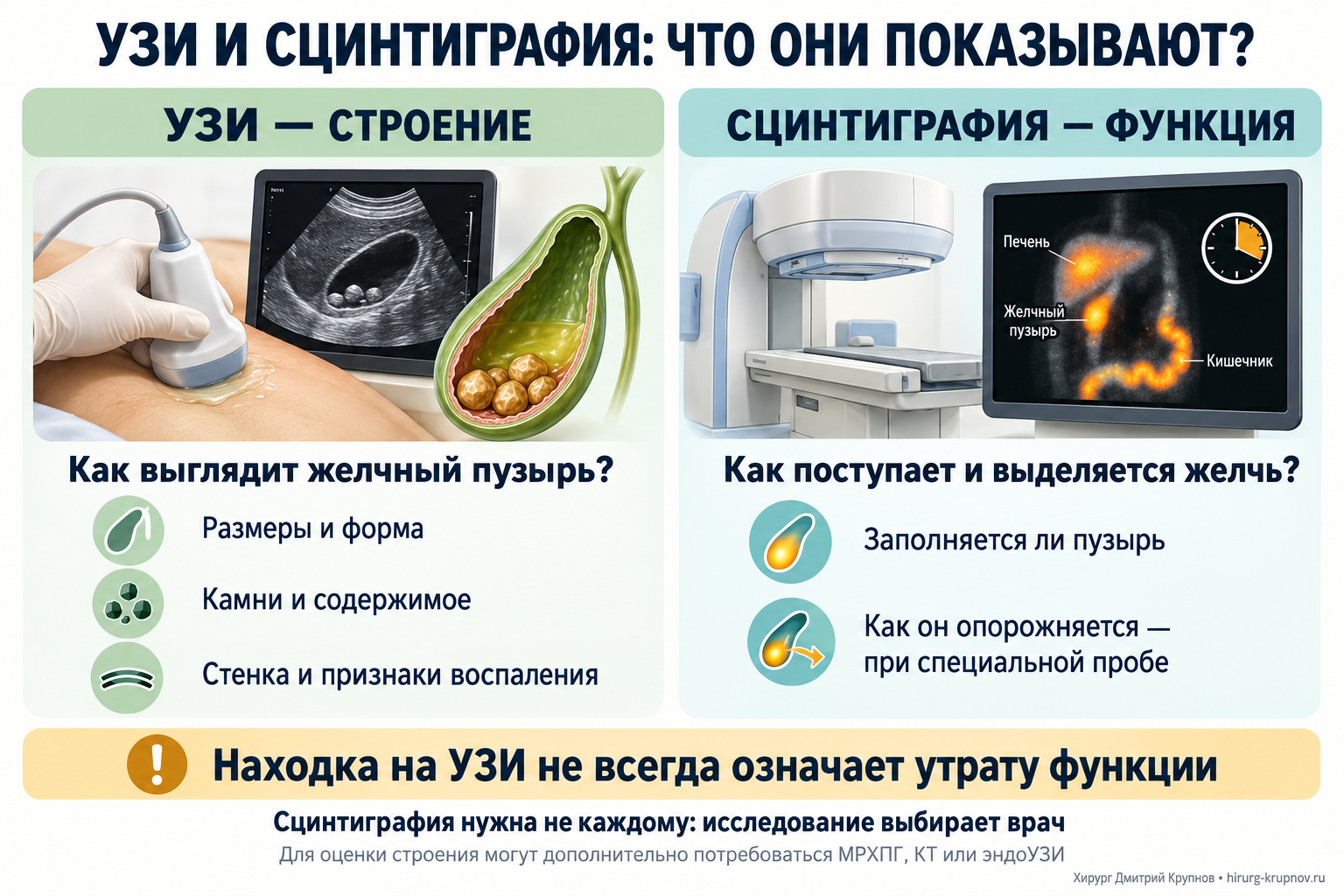 Стинтиграфия при отключенном желчном пузыре