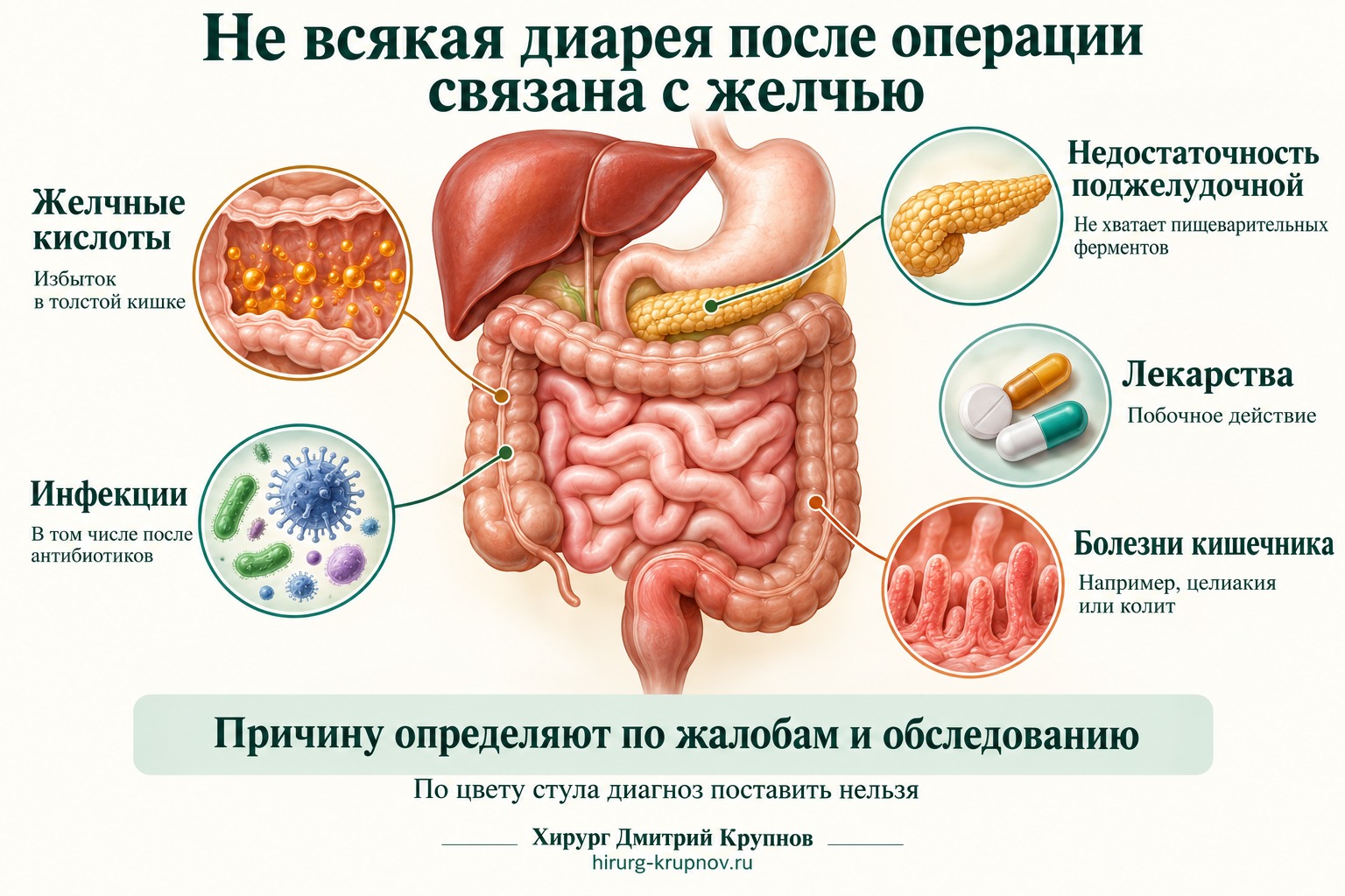 Не всякая диарея после операции связана с удалением желчного пузыря